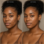 Pigment Perfecting Serum